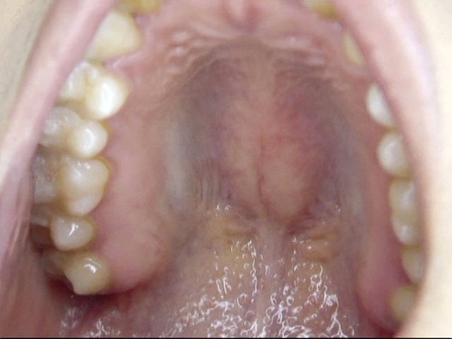 100人のおくち 第3集 ｜436ga00275