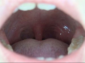 100人のおくち 第4集 ｜436ga00300