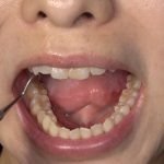 【歯・口内フェチ】「素人人妻マナミさんの超貴重な歯＆口内観察！」マナミ ｜h_1416ad01840